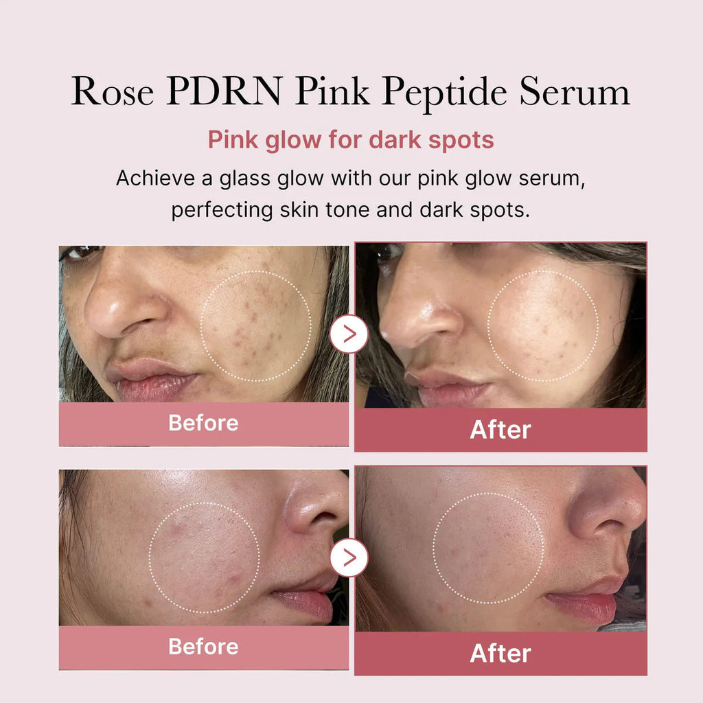 Medicube - PDRN Pink Peptide Serum 30ml